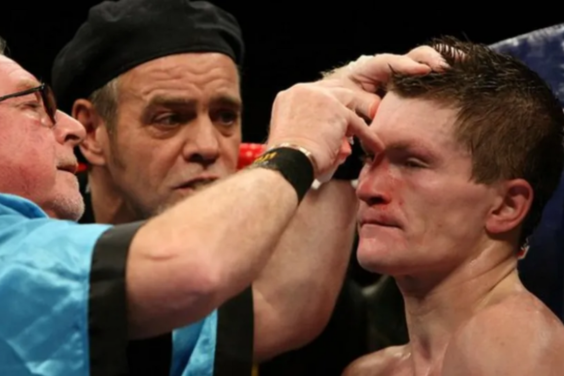 The Role of a Cutman in Combat Sports - Fan Arch