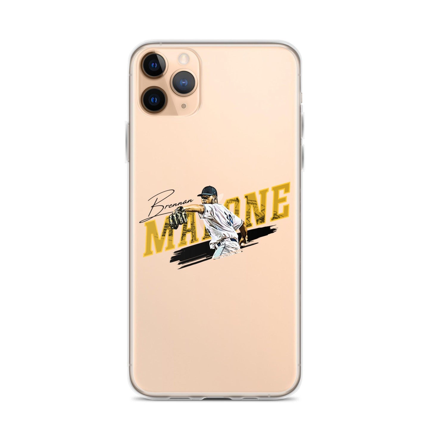 Brennan Malone "Windup" iPhone Case - Fan Arch