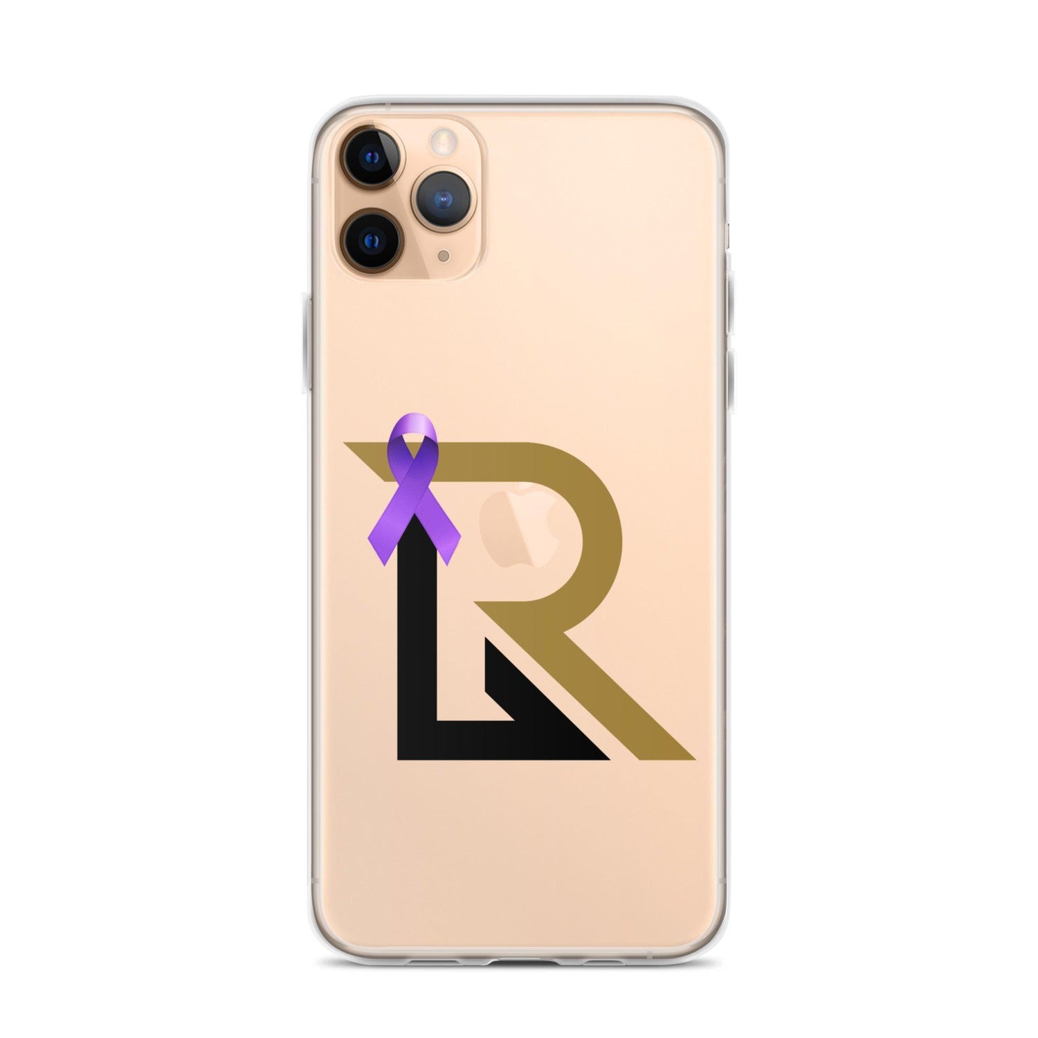 Rhett Lowder “RL” iPhone Case - Fan Arch