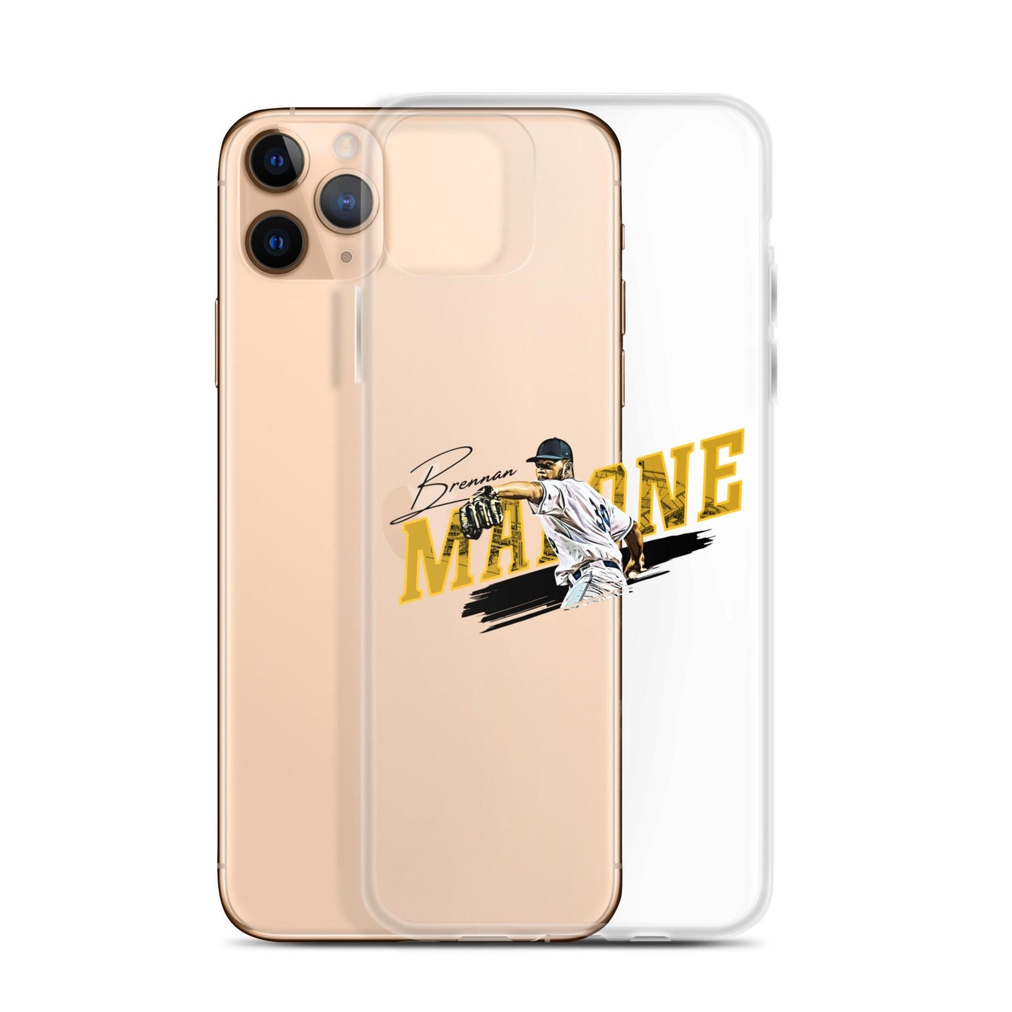 Brennan Malone "Windup" iPhone Case - Fan Arch