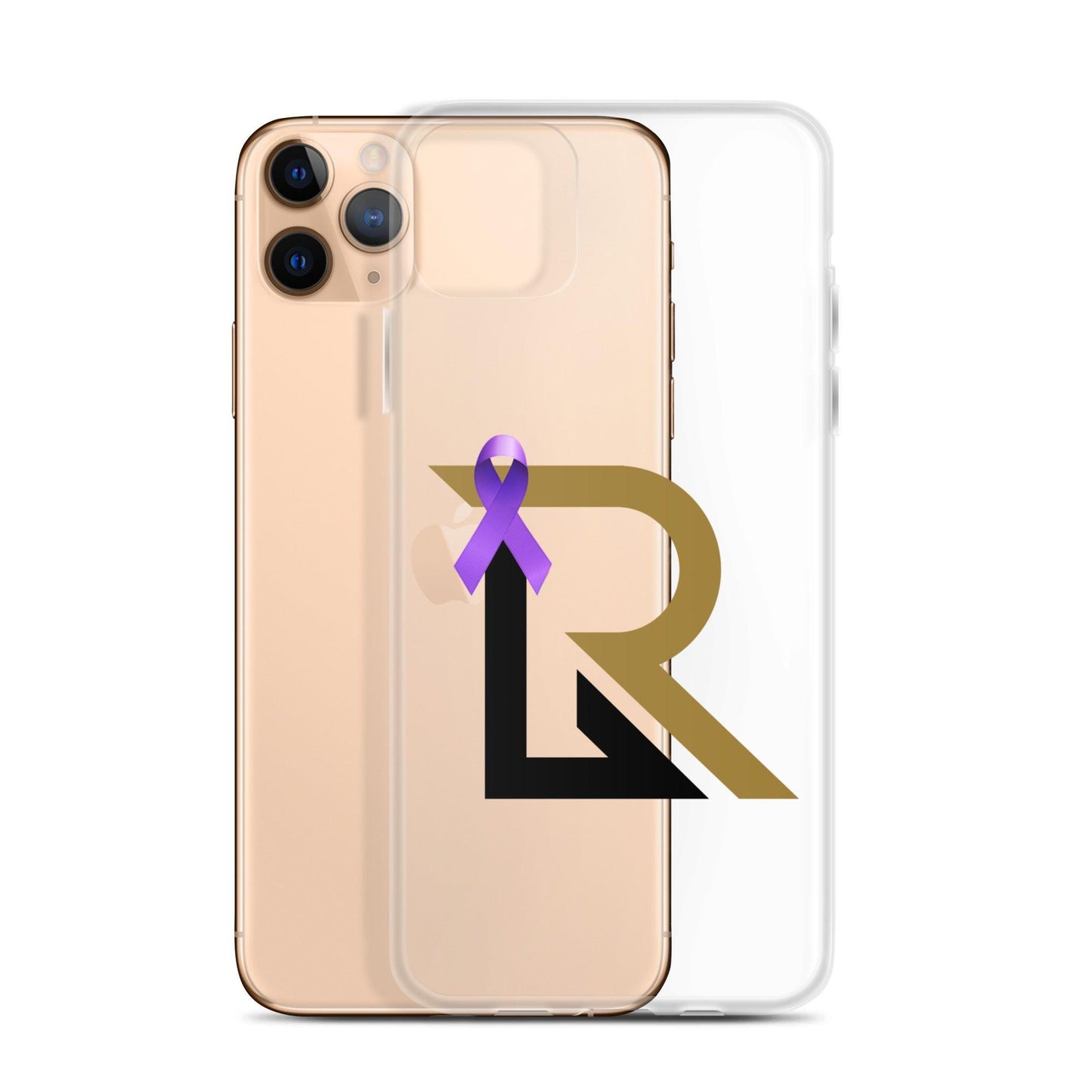 Rhett Lowder “RL” iPhone Case - Fan Arch